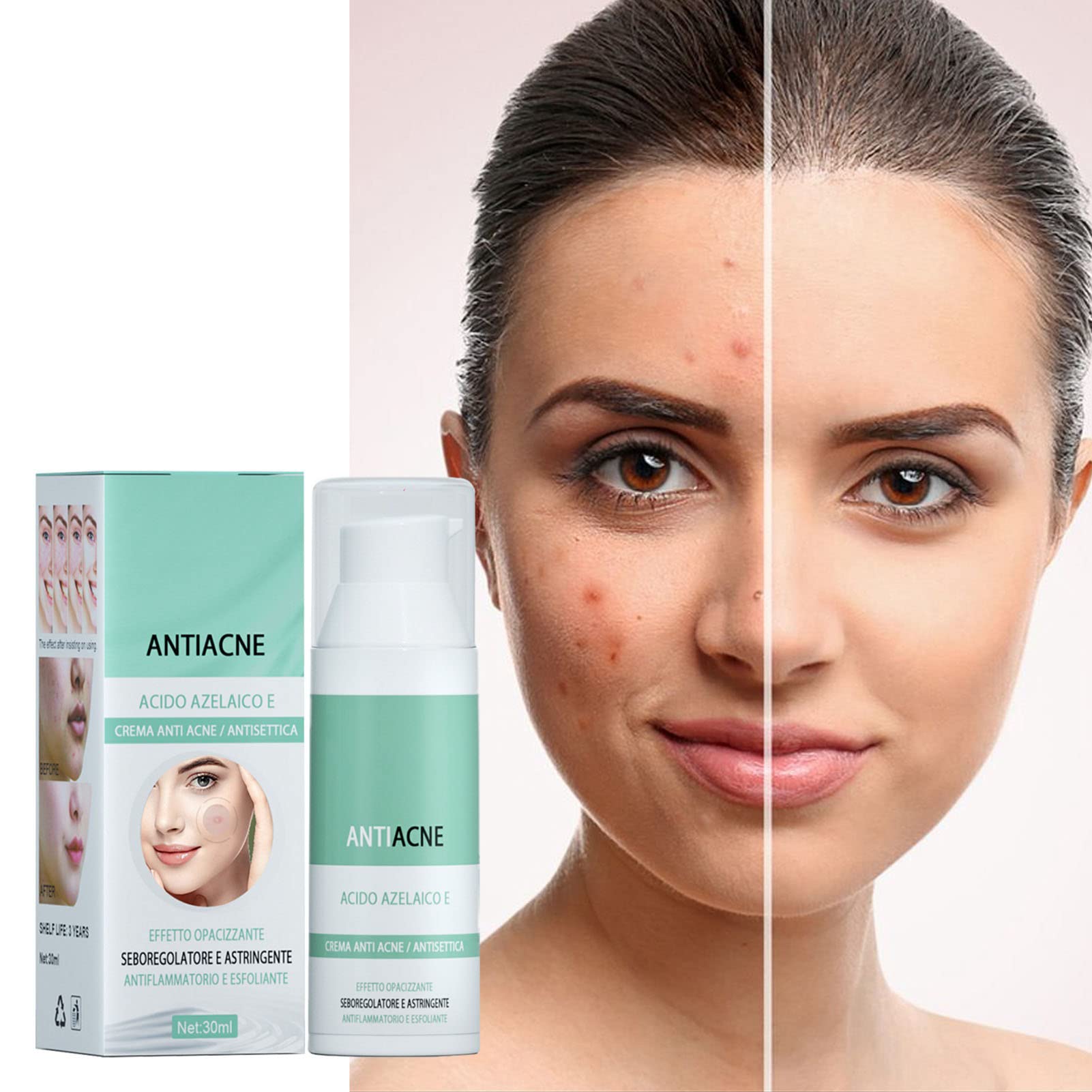 Gel Antiacne all'Acido Azelaico e Mandelico 💎